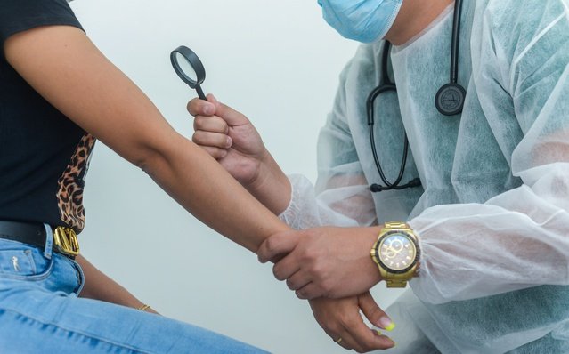 Rede de saúde de Palmas oferece tratamento a pacientes com vitiligo